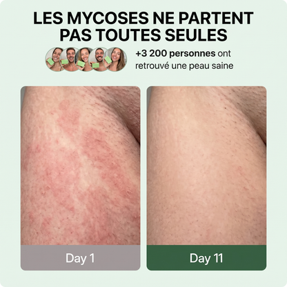 Naelova Savon Antifongique