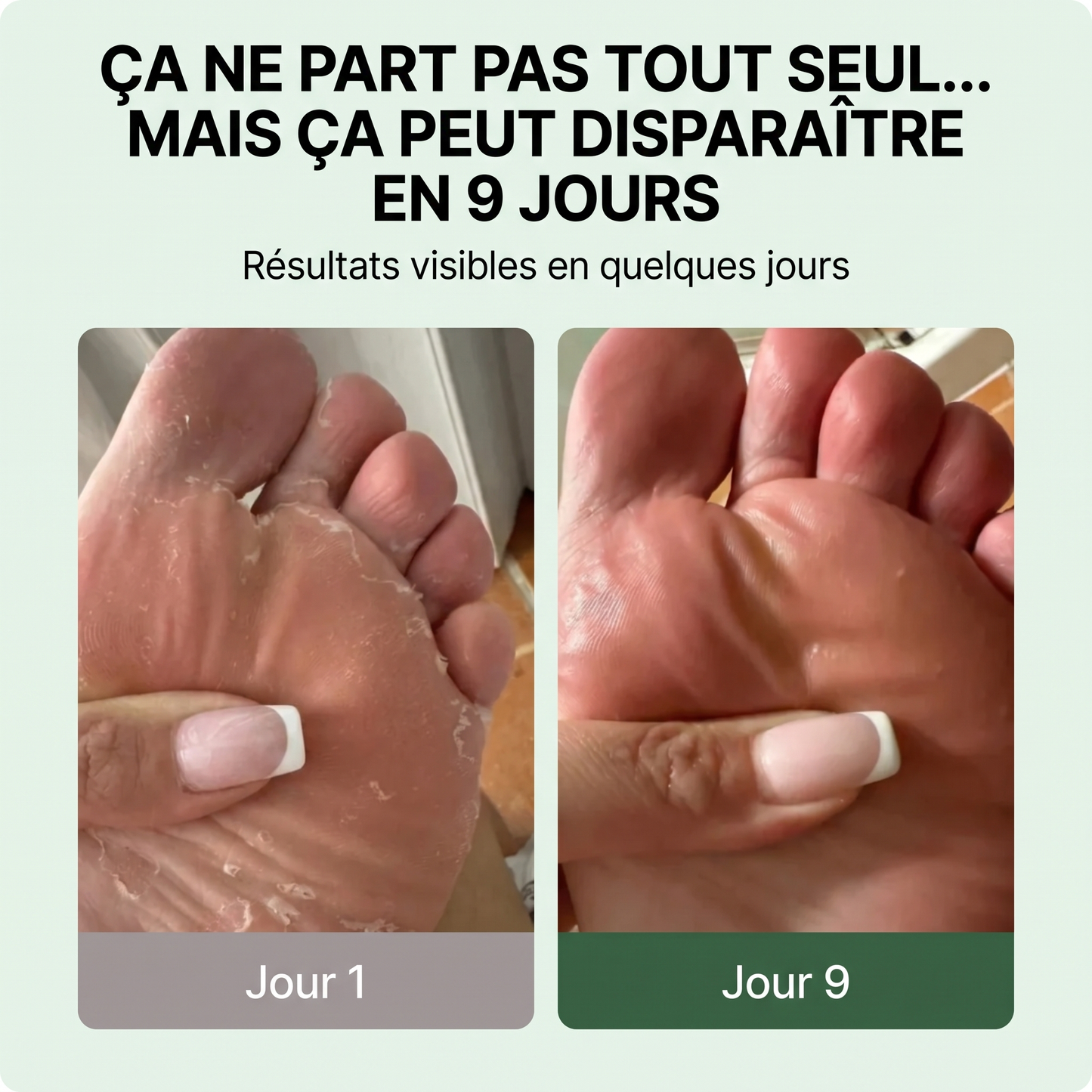 Naelova Savon Antifongique