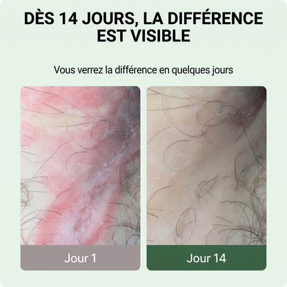 Naelova Savon Antifongique